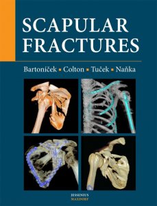 Scapular fractures (Naňka Ondřej)